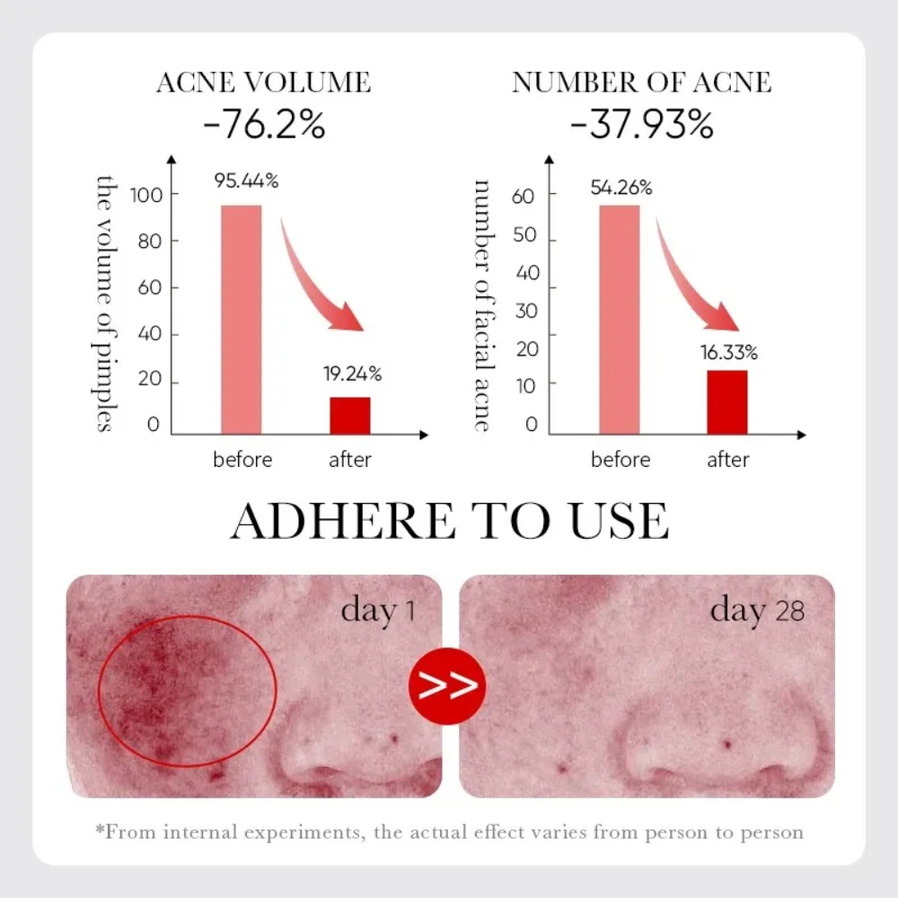 Sérum Reparador de Acné con Ácido Salicílico | Control de Grasa y Poros