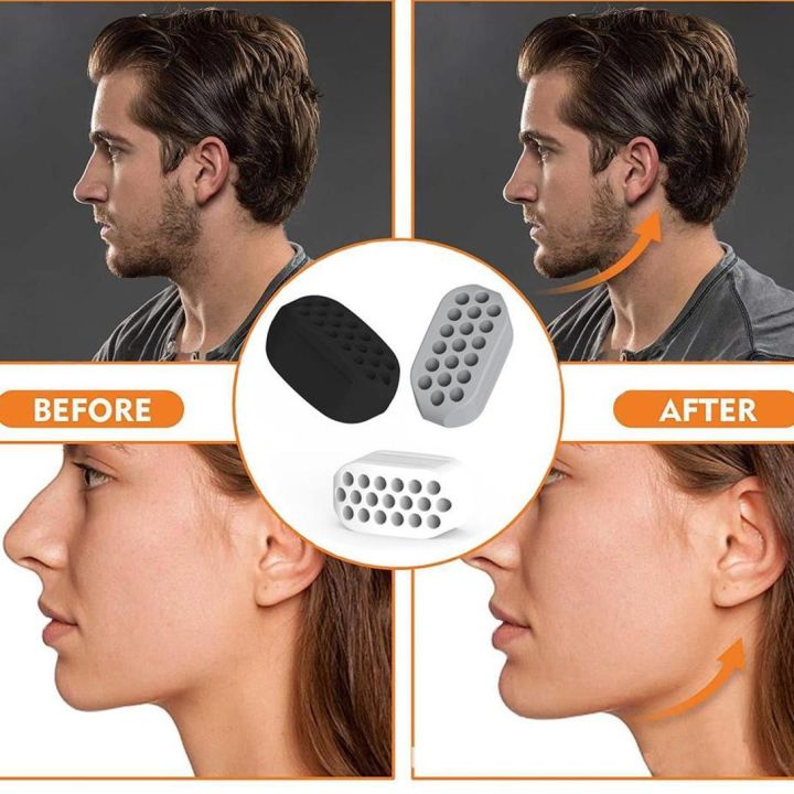 Kit de Gimnasia para Mandíbula ElitePro™ | Define tu Perfil Facial